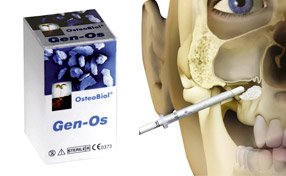 Terra Dent - echipament dentar